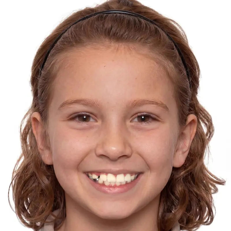 After treatment: Unblocking Eruption Pathways