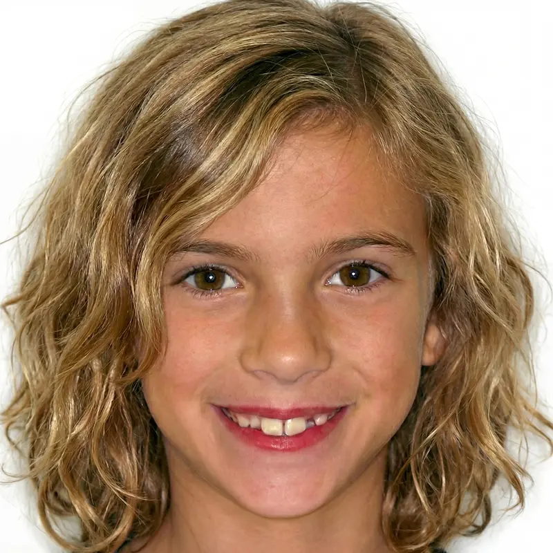 Before treatment: The Expansion Phase