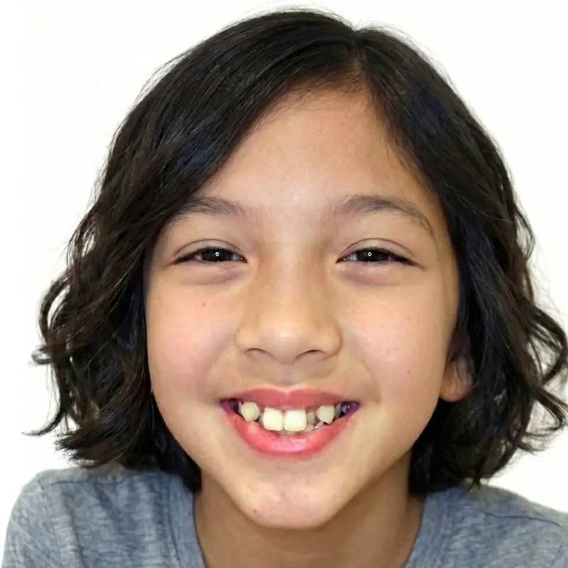 Before treatment: The Non-Extraction Arc