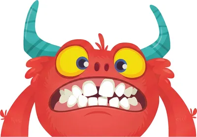 Illustration of Posterior Crossbite